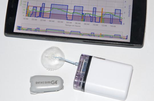 Diabète : des pompes à insuline innovantes