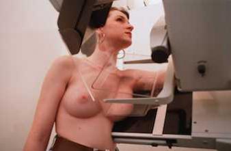 Cancer du sein : la nouvelle mutation génétique qui triple le risque