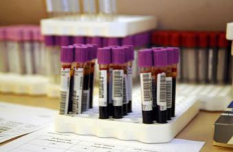 Dépister 13 types de cancer avec un test sanguin