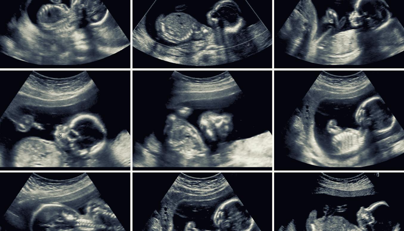 Développement du squelette : pourquoi les mouvements du foetus dans l'utérus sont importants