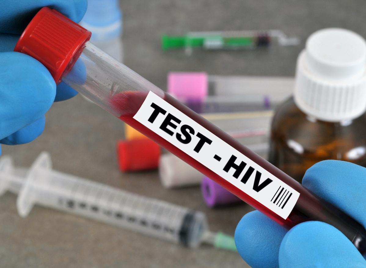 Avant la reprise d’une activité sexuelle, faites un test VIH