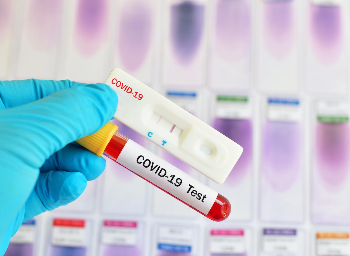 Les tests sérologiques, un complément selon la Haute Autorité de santé