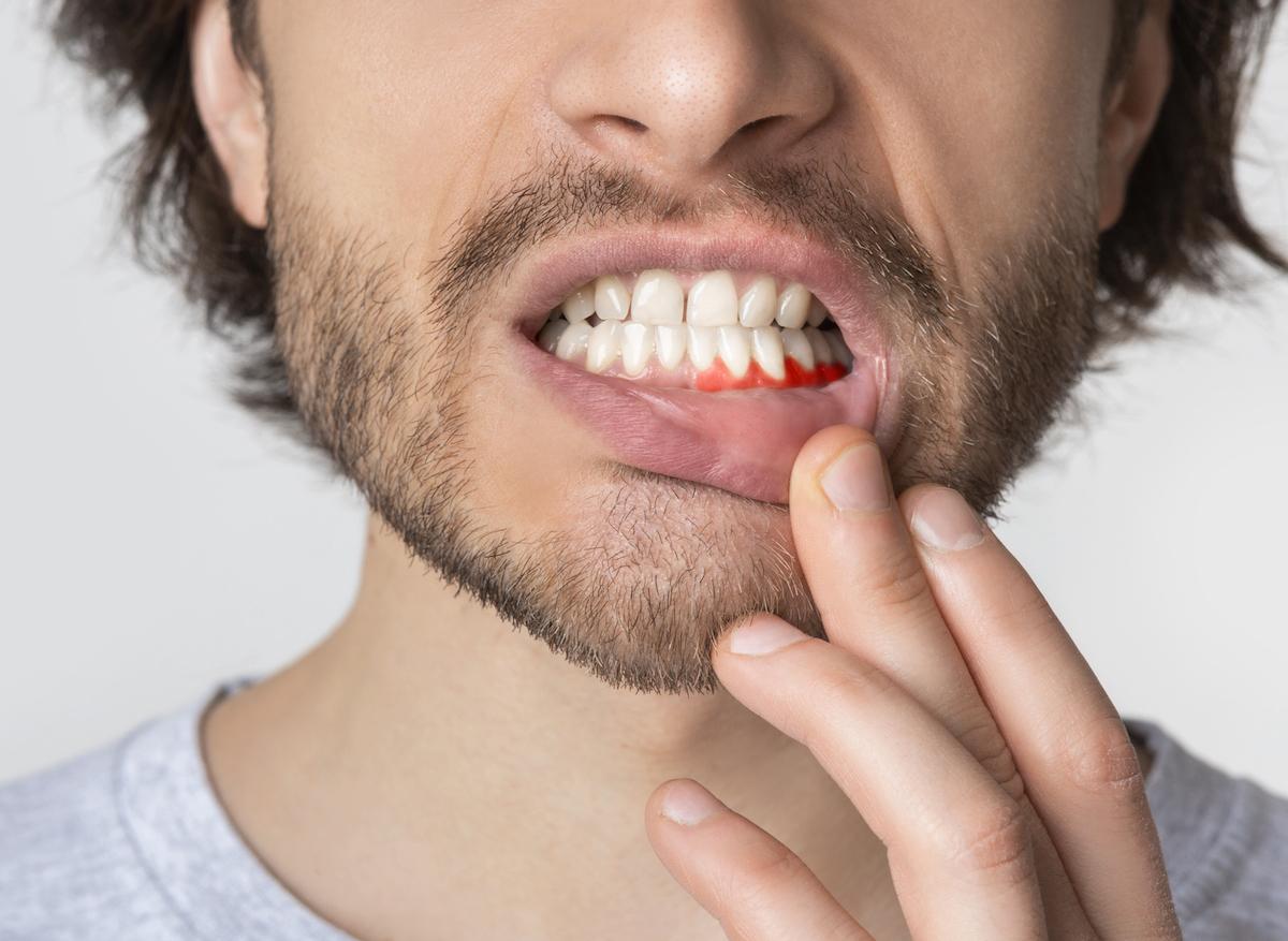 Covid-19 : une bonne hygiène bucco-dentaire protège