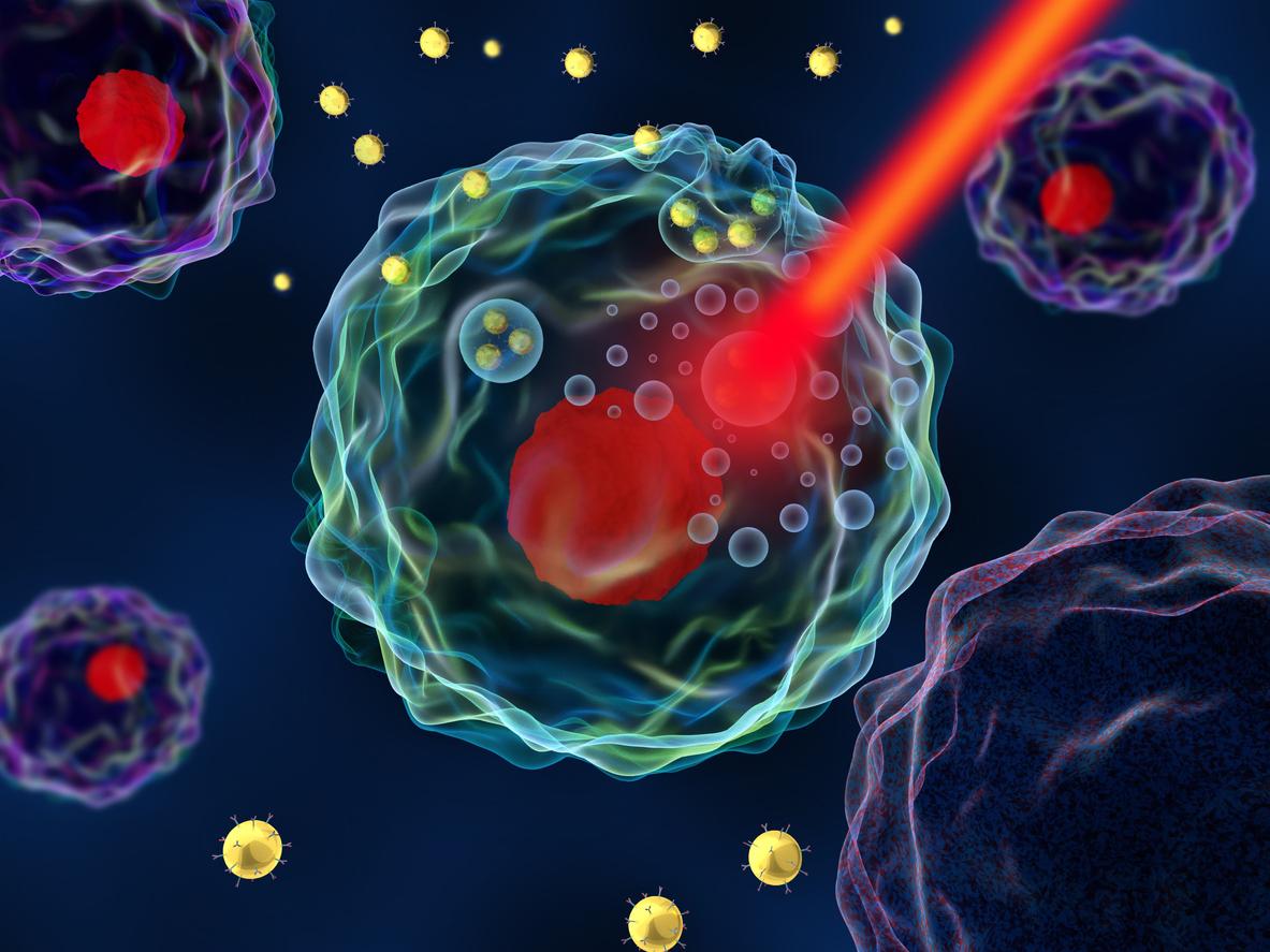 Cancer du pancréas : une administration des traitements par nanoparticules est prometteuse
