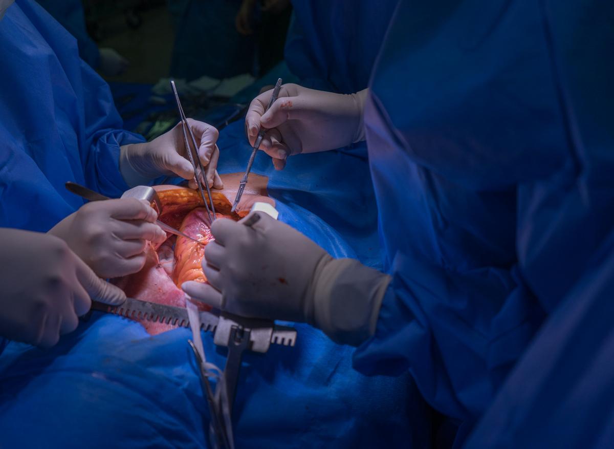 Covid-19 :  moins de chirurgies cardiaques depuis l'arrivée de la pandémie 
