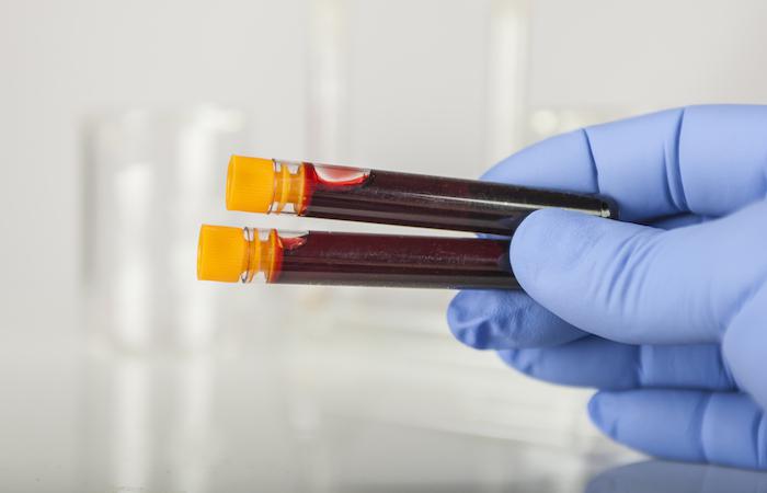 VIH : des chercheurs de Montpellier font une découverte majeure sur les cellules-réservoirs