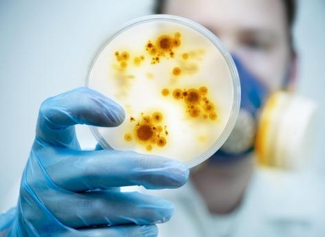 Des scientifiques promettent de détecter les bactéries au bout de 30 minutes