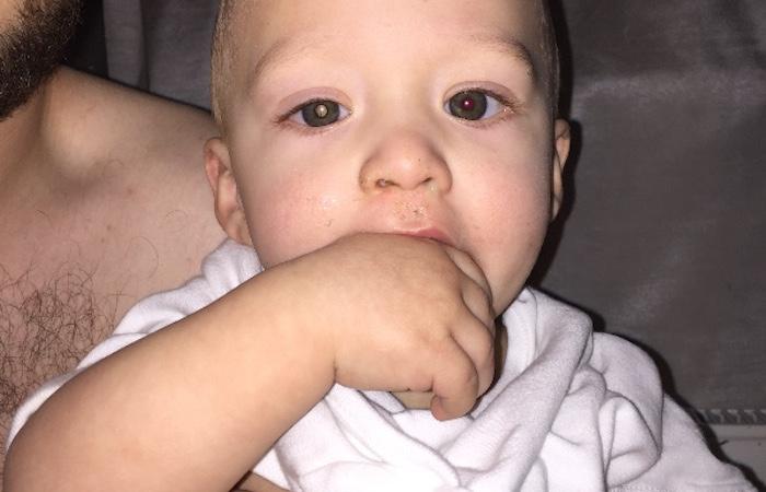 Rétinoblastome : une photo sauve un bébé de 14 mois