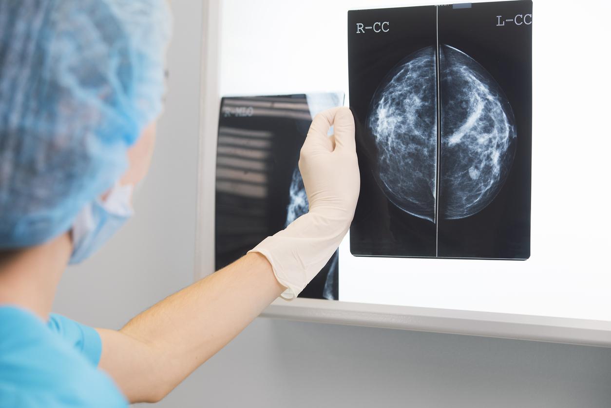 Cancer du sein : quand l’intelligence artificielle améliore le dépistage