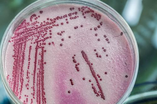 Antibiorésistance : 3 salmonelles sur 10 concernées en Europe