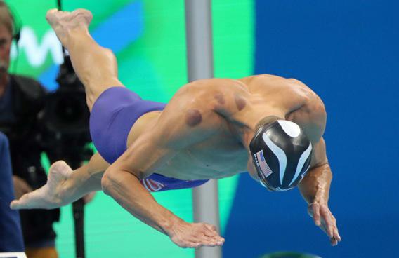 Rio 2016 : pourquoi les ventouses séduisent les athlètes