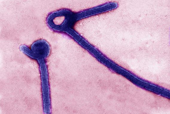 Ebola : les relations sexuelles déconseillées \
