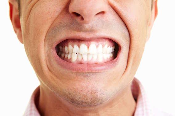 Une bactérie logée dans les dents augmenterait les risques d'AVC