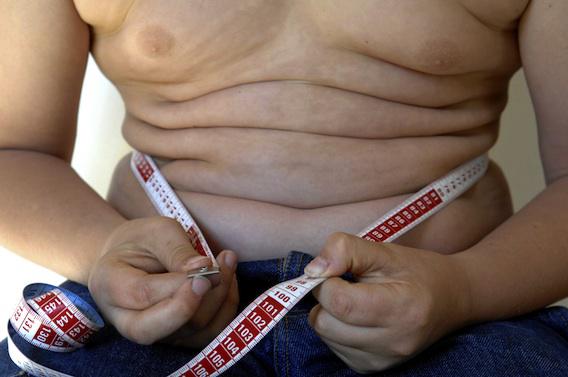 Enfants obèses : réduire le sucre améliore la santé en 10 jours