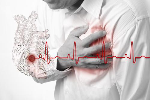 Maladies cardiovasculaires : une facture de 15 milliards d'euros par an en France