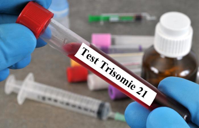 Grossesse : le dépistage de la trisomie 21 par prise de sang sera désormais remboursé 
