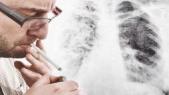 Cancer du poumon : le tabac à l'origine de dégâts sur l'ADN