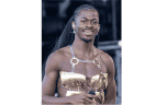 Lil Nas X souffre d’une paralysie partielle du visage : quelles sont les causes ?