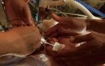 Lésions cérébrales chez les bébés : la surprenante piste du lait maternel intranasal