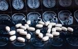 Alzheimer : une étude met en avant l’efficacité de ces médicaments déremboursés en France