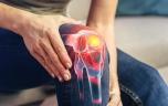 Arthrose du genou : un test sanguin peut détecter la maladie avant les radios