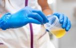 Les troubles mentaux laissent-ils des traces dans l’urine ?