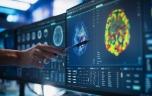 Un cerveau virtuel conçu pour prédire l’impact d’une lésion ou d'une intervention médicale