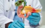 Cancer du pancréas : une nouvelle radiothérapie ciblée prometteuse