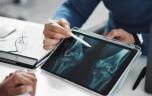 Arthrose du genou : un espoir pour soulager la douleur ?