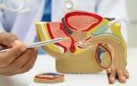 Ce phénomène qui explique comment le cancer de la prostate se développe 