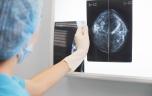 Cancer du sein triple négatif : une nouvelle cible thérapeutique découverte