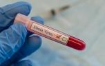 Urgence sanitaire en RDC : la souche d’Ebola présente “un taux de létalité très élevé”