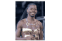 Lil Nas X souffre d’une paralysie partielle du visage : quelles sont les causes ?