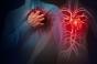 Insuffisance cardiaque : 6 moyens efficaces de prévenir la maladie