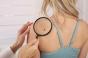 Immunothérapie dans le mélanome : les doses moins fortes seraient plus efficaces