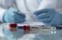 Ebola en RD Congo : les raisons d’une 