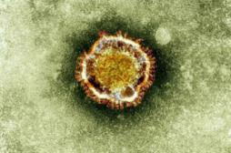 Le coronavirus MERS progresse au Moyen-Orient