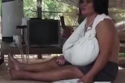Hypertrophie mammaire : la poitrine de cette femme grossit à vue d’œil depuis 9 mois
