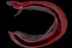 Bilharziose : un parasite vieux de 6200 ans découvert en Syrie