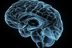 Lésions cérébrales : quand un hémisphère compense les défaillances de l’autre