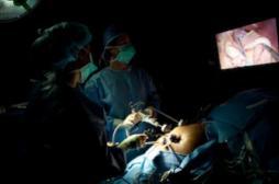 La chirurgie bariatrique réduit le risque de cancer de l'utérus