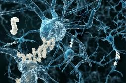 Alzheimer : la progression de la maladie filmée dans le cerveau de la souris