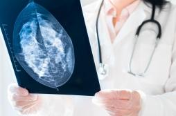 Cancer du sein : attention aux mammographies 