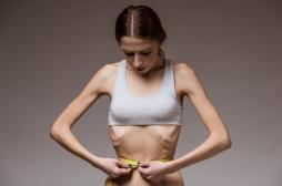 Anorexie : la stimulation transcrânienne peut réduire les symptômes 