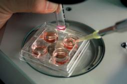 Congélation d’ovocytes en France : pour raisons médicales uniquement