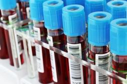 Biopsie liquide : détecter les cancers grâce à une prise de sang