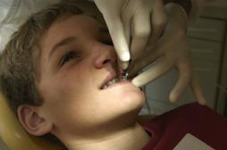 Dentaire : les soins d'orthodontie accusés d'être trop chers