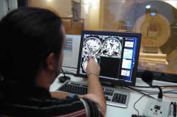 Alzheimer : des chercheurs français découvrent une nouvelle protéine 
