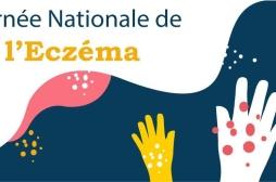 Eczéma chronique des mains : quelles précautions prendre au quotidien ?