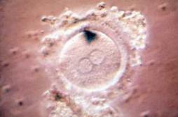 Infertilité : premiers essais de création d'ovules et de sperme artificiels 